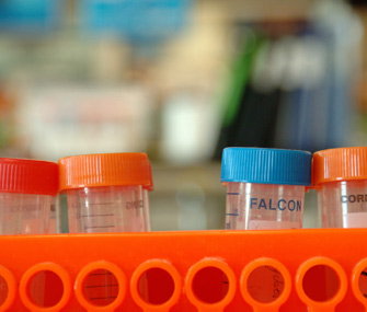 Test tubes