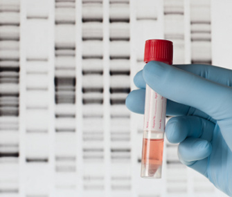 DNA testing