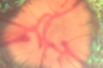Quiz 3 -new Image
