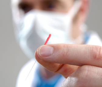 Vet holding acupuncture needle