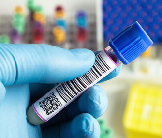 Blood sample